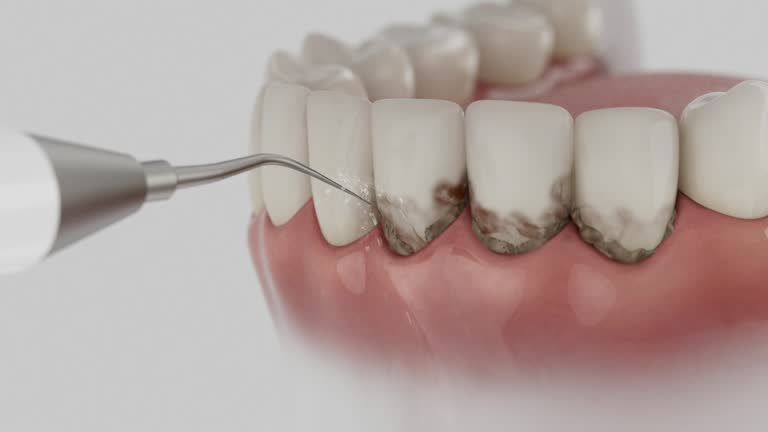 Trusted Wisdom Tooth Removal service in Henry, IL - Dentist Open Now